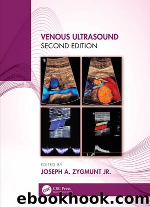 Venous Ultrasound by Zygmunt Jr. Joseph A.;